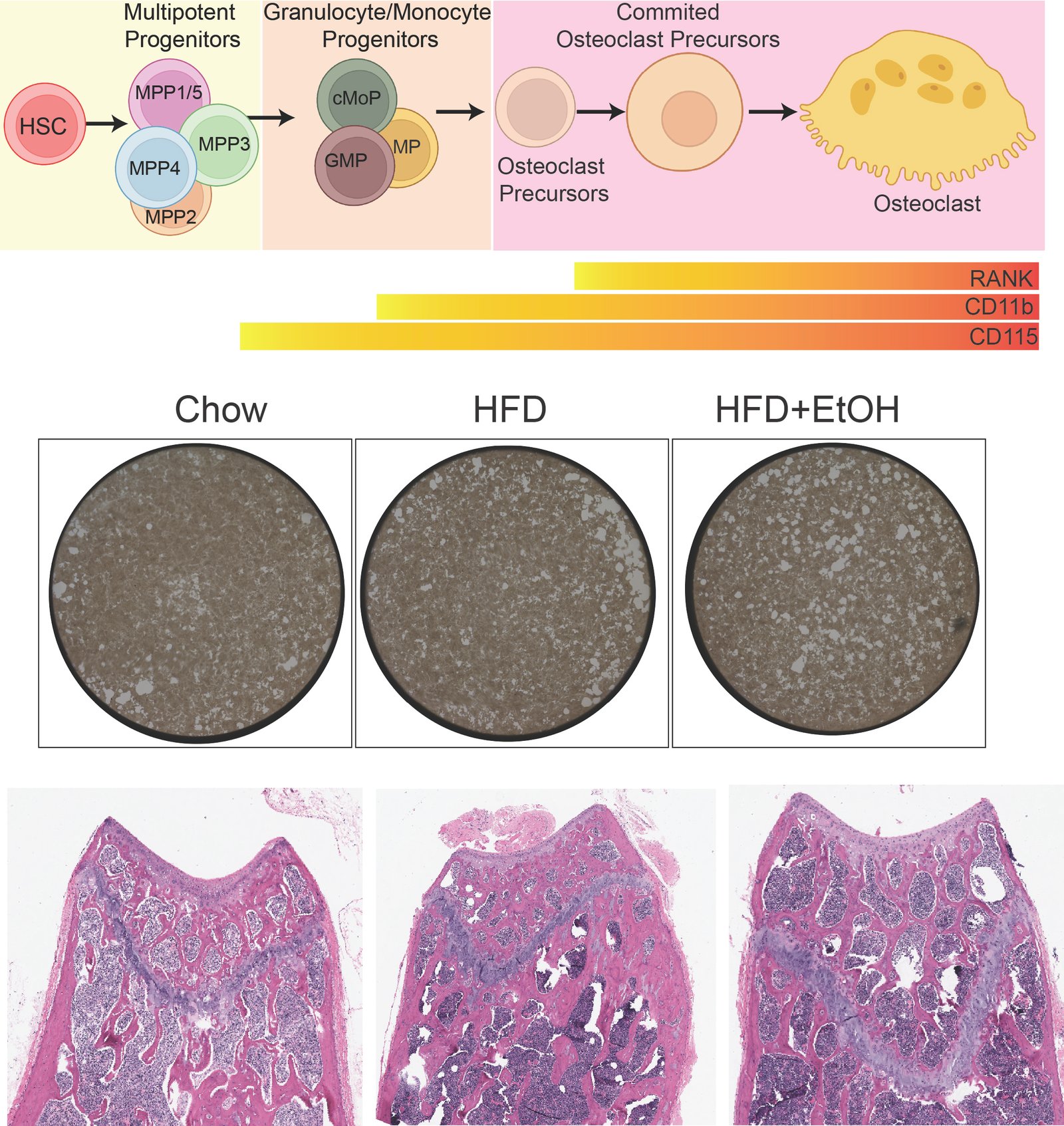 Alcohol consumption exacerbates high-fat diet-mediated disruptions in myelopoiesis and osteoclastogenesis in mouse models of metabolic dysfunction-associated liver diseases
