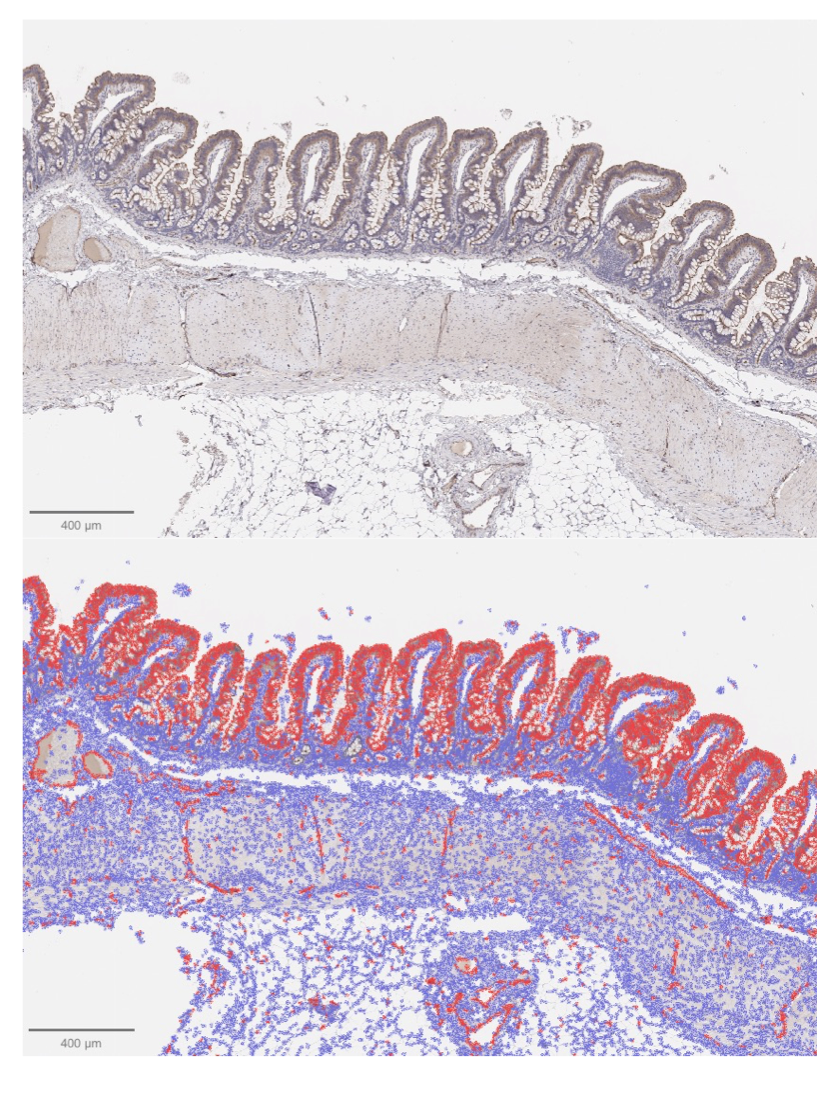 Borreliosis and doxycycline treatment disrupt gut microbiota and immune responses in nonhuman primates